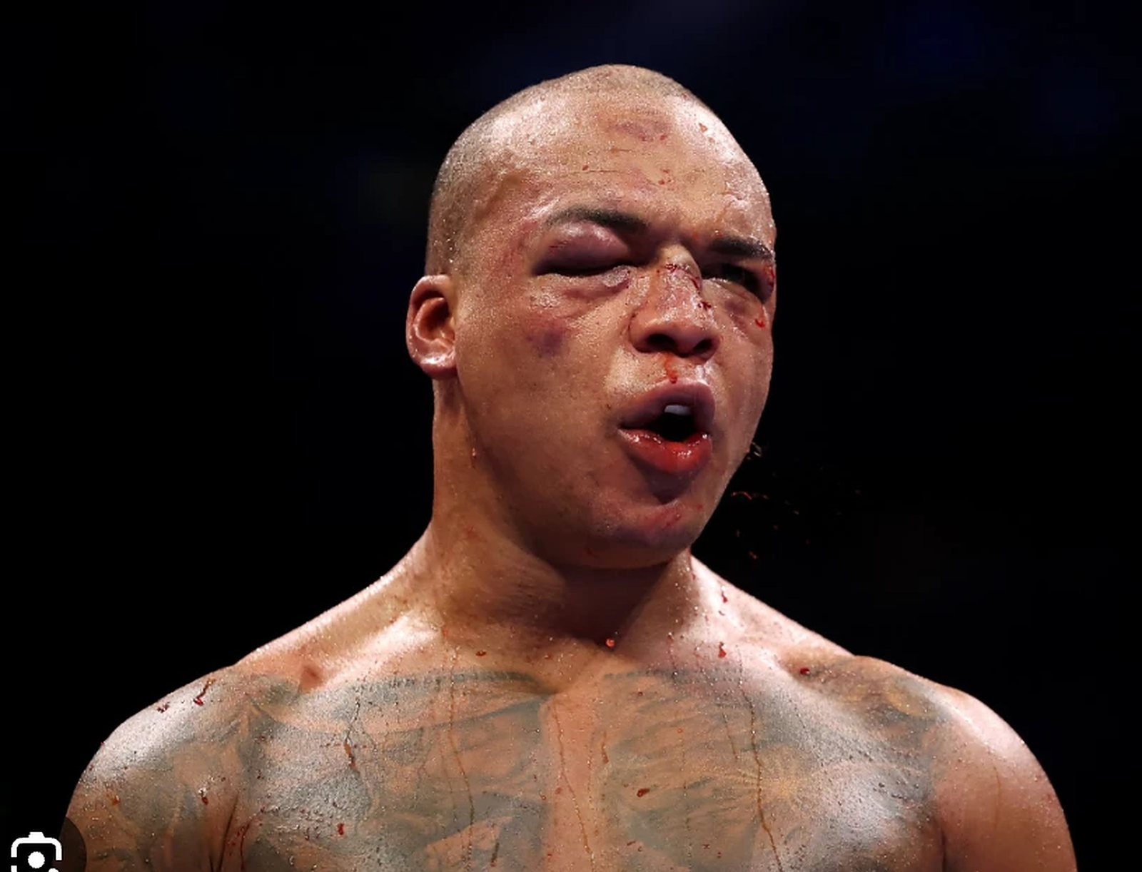 Wardley's swollen, bloodied face